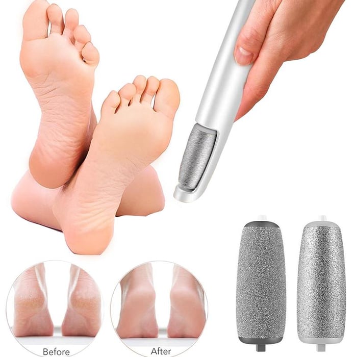 ??Hot Sale - 50% OFF??Electric Feet Callus Remover?