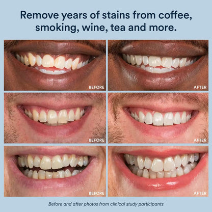 KLENIMORE® 🦷 Tideglusib Fast‑Dissolving Tooth & Gum Repair Oral Strips 💥🎉 (Supports tooth repair and helps relieve gum discomfort and other common oral concerns)