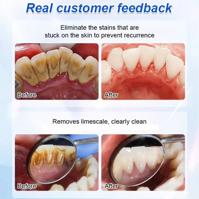 Whitening Tooth Care Restorative Toothpaste