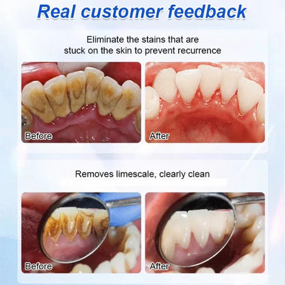 Whitening Tooth Care Restorative Toothpaste